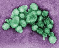 Imagen del virus de la influenza A H1N1 (cepa A/CA/4/09)